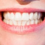歯並びが悪いスピリチュアルな意味とは！？